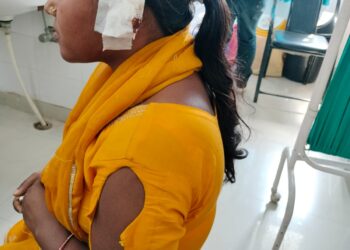 पांवटा साहिब  में बंदरों का आतंक , माहिला पर हमला कर किया घायल