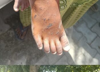 पांवटा साहिब : युवती और बच्चे पर जानलेवा हमला , आरोपियों के खिलाफ कड़ी कार्रवाई की मांग