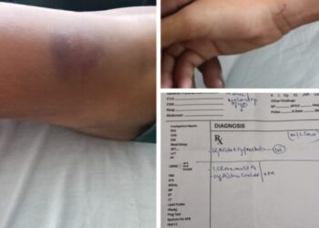 पांवटा साहिब  में  बच्चे की टीचर द्वारा पिटाई , पुलिस जांच में जुटी