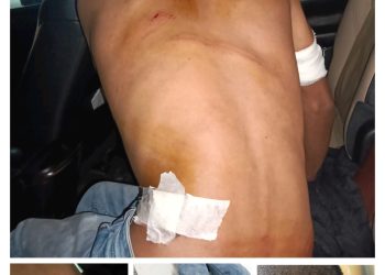 पांवटा साहिब में बिगड़ी कानून व्यवस्था , पुलिस बनी तमाशबीन , युवक पर जानलेवा हमला , नशे और गैंगवॉर से जुड़ा है मामला