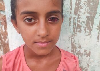 शिलाई : धकोली स्कूल में टीचर ने 5वीं कक्षा की छात्रा को पीटा, आंख क्षतिग्रस्त – हायर सेंटर रेफर, भीम आर्मी ने की निंदा