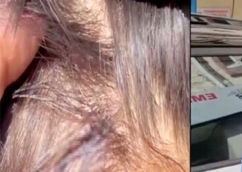 टीचर की बेरहमी! चौथी कक्षा के छात्र को लोहे के स्केल से पीटा, सिर में आई चोट