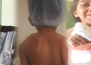 पहली बार में ही सफल हुई बच्चे की बड़ी सर्जरी, मां-बाप छोड़ चुके थे ठीक होने की उम्मीद