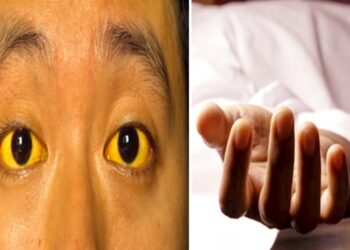 मंडी के गोहर में पीलिया फैलने से मचा हड़कंप, 42 लोग चपेट में…एक युवक की गई जान